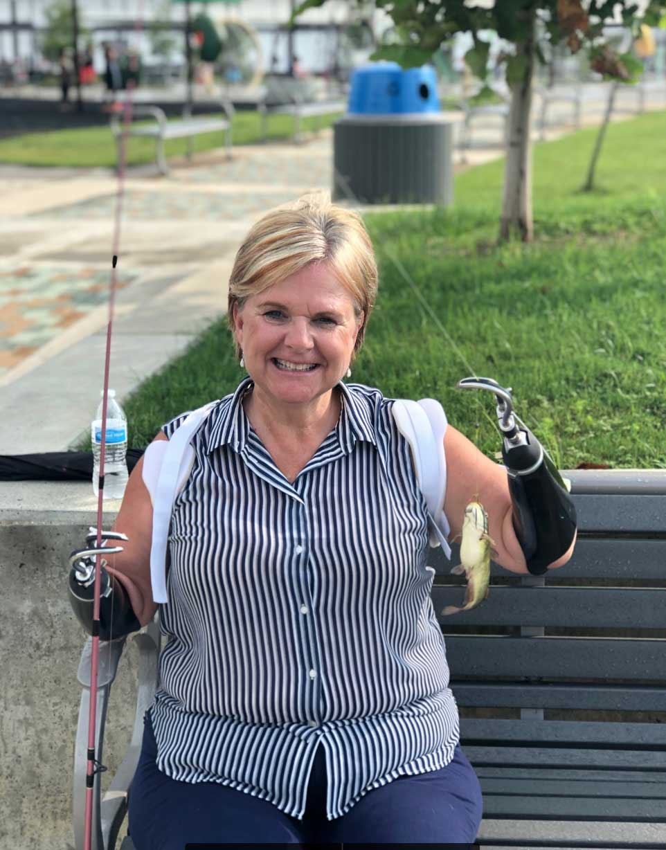 Julie Dunn Fishing while using Prothetic Arms